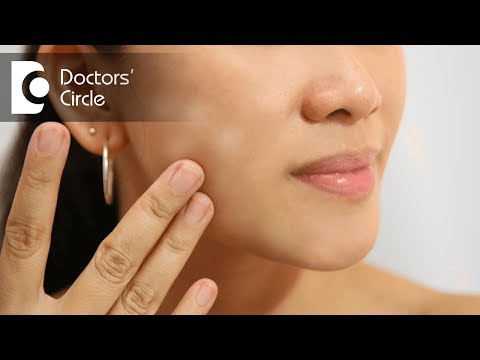What causes white spots on face? - Dr. Rasya Dixit