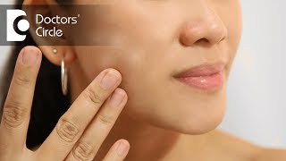 What causes white spots on face? - Dr. Rasya Dixit