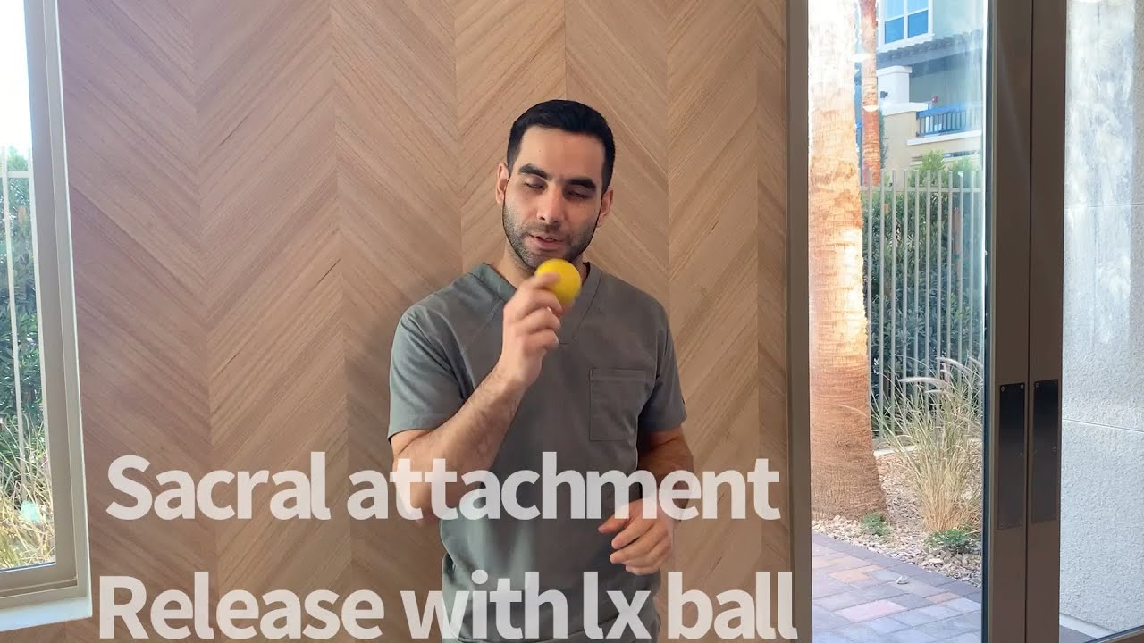 Lx ball sacral attachment release