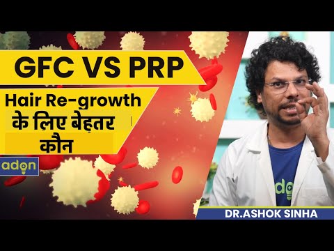GFC & PRP Difference | Which Is Better | Hair Regrowth | Hair Loss | Growth Factor Concentrate