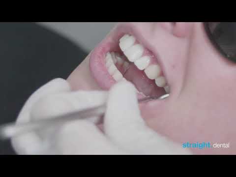 QuickSleeper: Einführung in die 3 Phasen Vorbetäubung, Rotation, Injektion