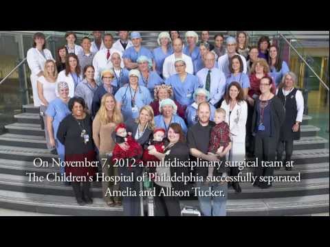 Conjoined Twins Successfully Separated at The Children's Hospital of Philadelphia