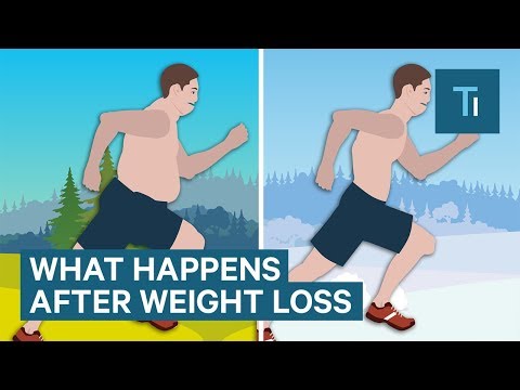 How Losing Weight Affects the Brain and Body