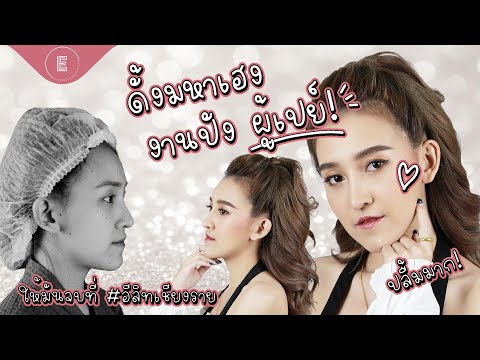 เสริมจมูกที่ Elite Clinic ดั้งพุ่ง ! งานรุ่ง ! มีผู้เปย์  