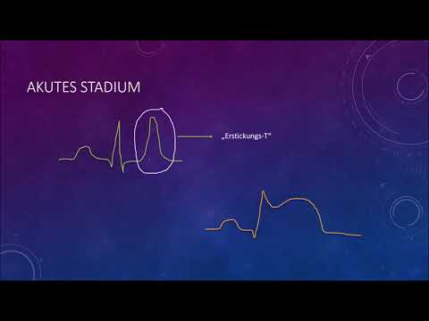 EKG Crashkurs, Teil 5: Herzinfarkt