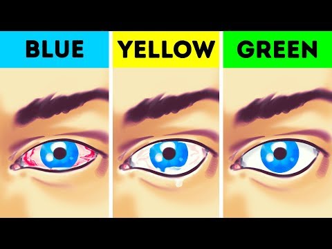 download lagu mp3 mp4 Which Color Is Good For Eyes, download lagu Which Color Is Good For Eyes gratis, unduh video klip Which Color Is Good For Eyes