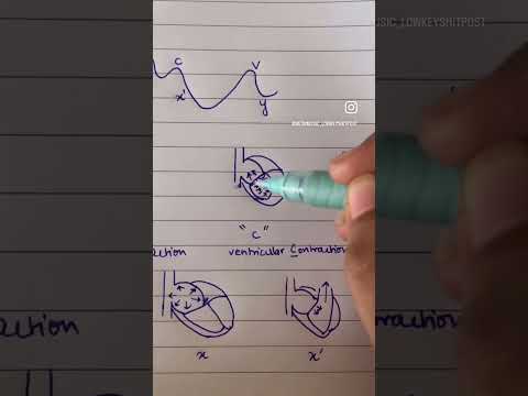 Jugular Venous Pressure (JVP) explained