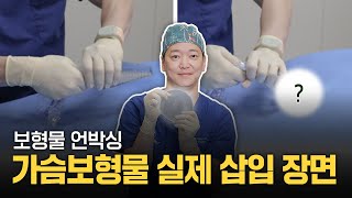 ※실제 가슴보형물 삽입 과정 대공개※ 가슴보형물 이렇게 들어갑니다! [feat. 보형물 언박싱]
