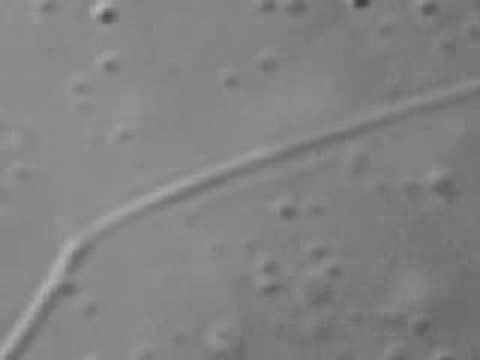 17 6 organelle movement (MOVIMENTO DE ORGANELAS ATRAVÉS DO MICROTÚBULO)