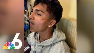 Teen brutally beaten at Broward school, father seeks change