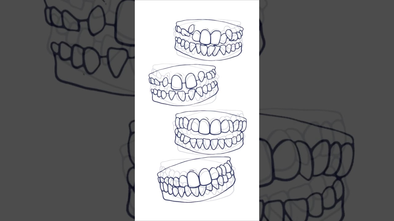 Dennis Ulloa Pinedo-16