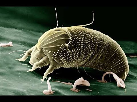 [NEU!] Die Rache der Schöpfung (3/3) Angriff der Parasiten [Dokumentarfilm HD]