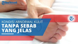 Parestesia, Kondisi Timbulnya Sensasi pada Kulit yang Abnormal Tanpa Penyebab yang Jelas