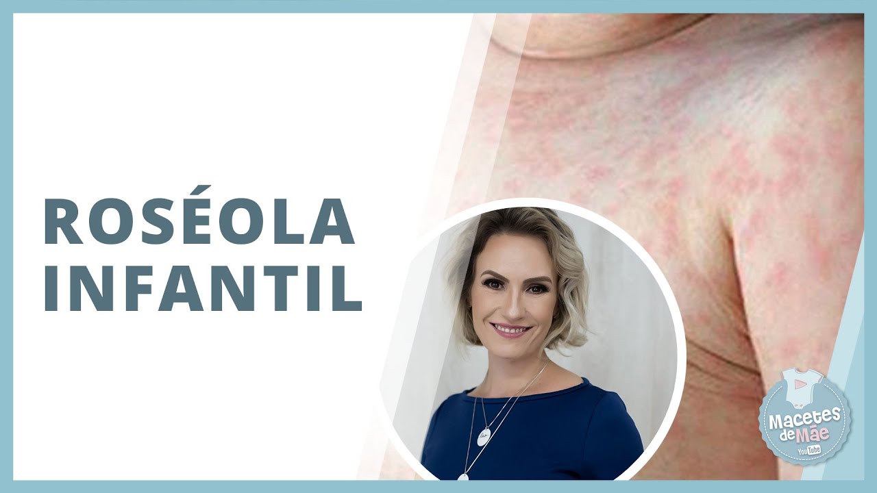 ROSÉOLA EM BEBÊS: SINAIS E SINTOMAS