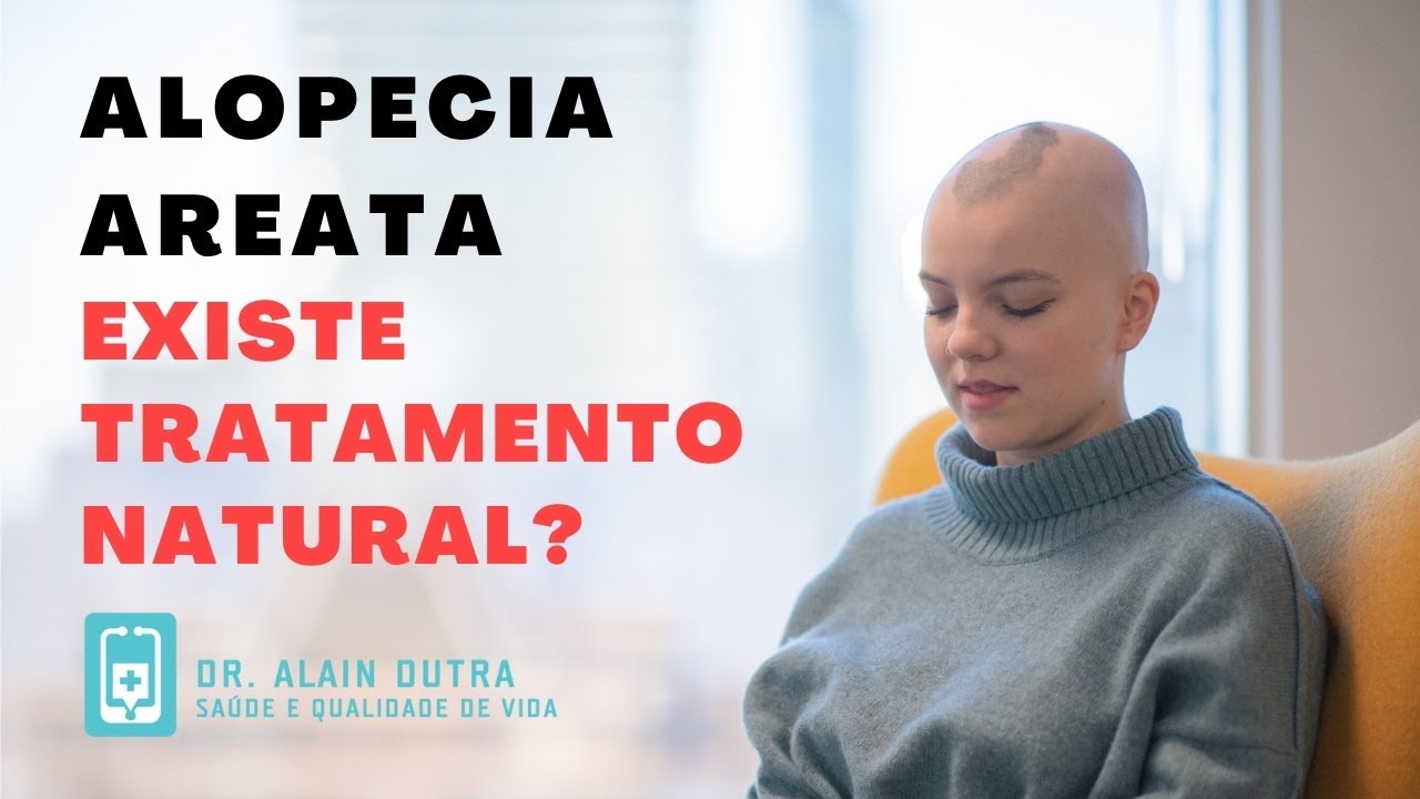 Dr. Alain Dutra fala sobre a ALOPECIA AREATA e tratamentos naturais