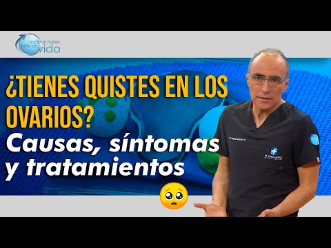 ¿Tienes Quistes en los Ovarios? ¡Descubre Causas, Síntomas y Tratamientos! 💡🥺