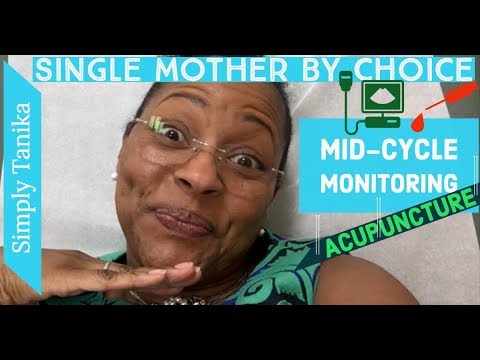 IUI Cycle Monitoring and Acupuncture (New Place!) Video