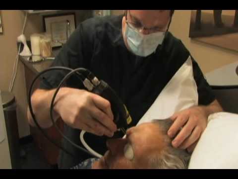 Full Face Juvia Fractionated CO2 Laser Resurfacing | Orlando Medical Spa