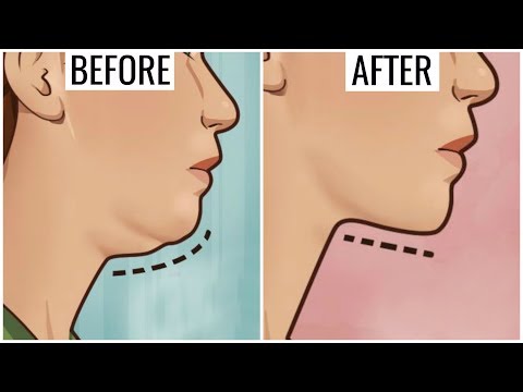 Get Rid of DOUBLE CHIN & NECK FAT Permanently - How to Look Slim | Anaysa