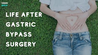 Life After Gastric Bypass Surgery