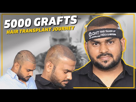 Hair Transplant in Mumbai | Best Results & Cost of...