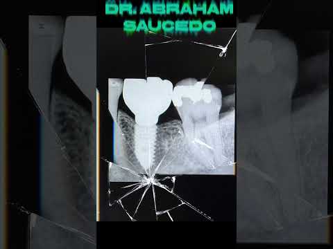 Abraham Saucedo Reyes-25
