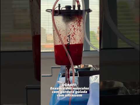 Cada vez mais os homens estão buscando a cirurgia plástica