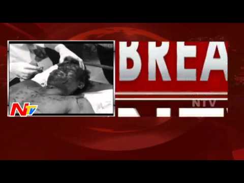 Lawyer Was Brutally Assassination In Eluru | Breaking News | NTV