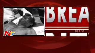 Lawyer Was Brutally Assassination In Eluru | Breaking News | NTV