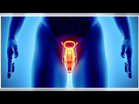 Leucociti in microscopia secreto prostatico Vitaprost allergia candele