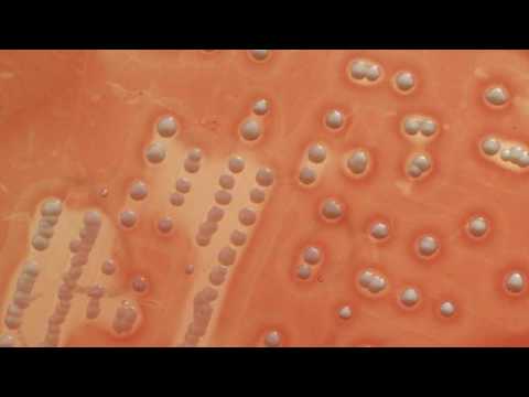 Difference Between Niacin and Niacinamide