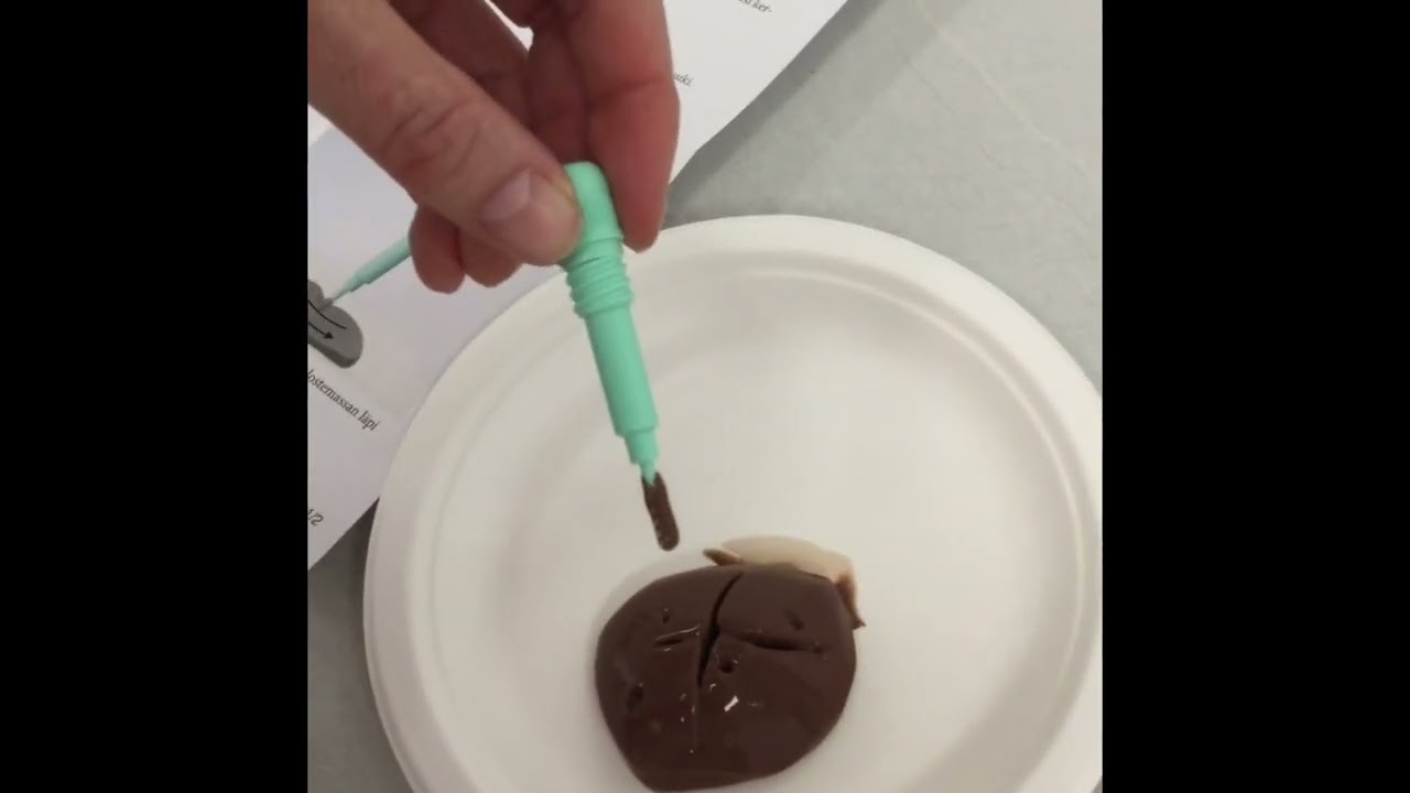 Suolistosyöpätesti - millainen se oikein on?