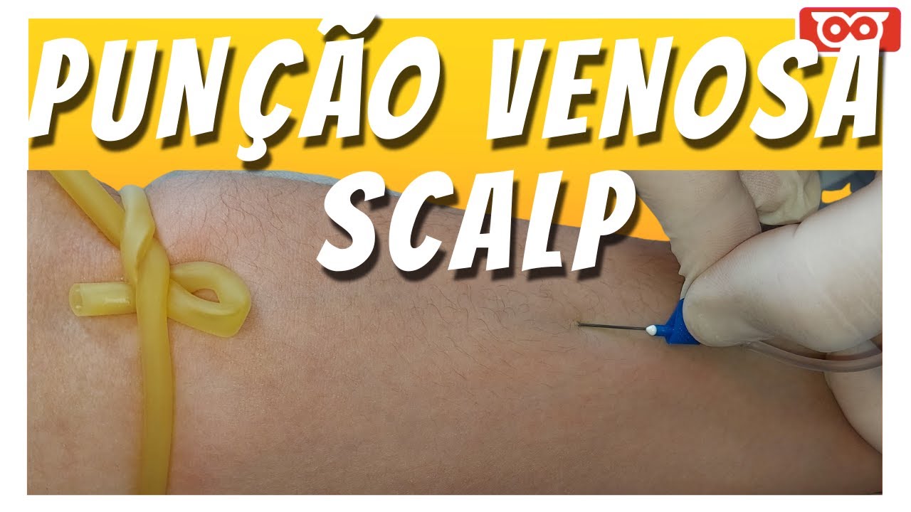 PUNÇÃO VENOSA COM SCALP - Aula Prática