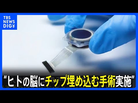 イーロン・マスクの脳チップは機能するのか?精神の力で「ポン」をする猿