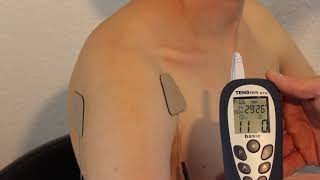 Elektrodenanlage Schulter mit TENStem eco basic DE