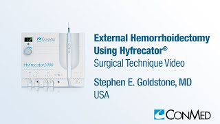Dr. Stephen Goldstone - External Hemorrhoidectomy Using Hyfrecator® - CONMED Surgical Technique