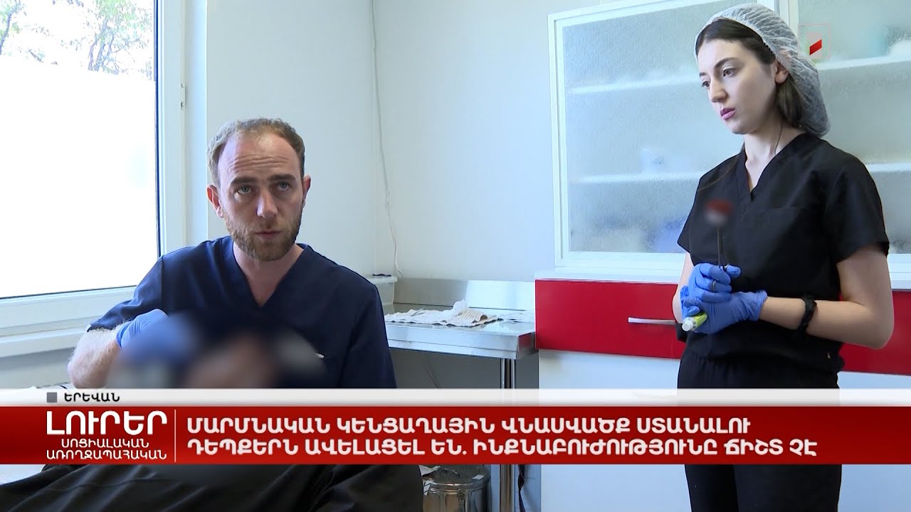 Մարմնական կենցաղային վնասվածք ստանալու դեպքերն ավելացել են. ինքնաբուժությունը ճիշտ չէ