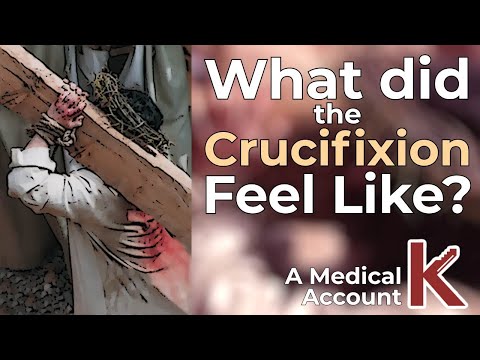 Medically, what was it like for Jesus to be Crucified?