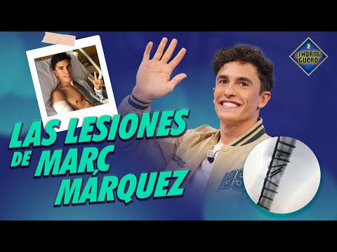Marc Márquez nos habla de cómo ha vivido su última lesión - El Hormiguero