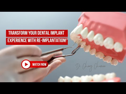 How Does the Tooth Move? Video