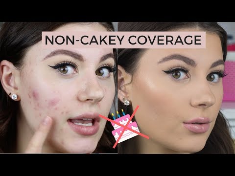 HOW TO COVER ACNE | NON CAKEY