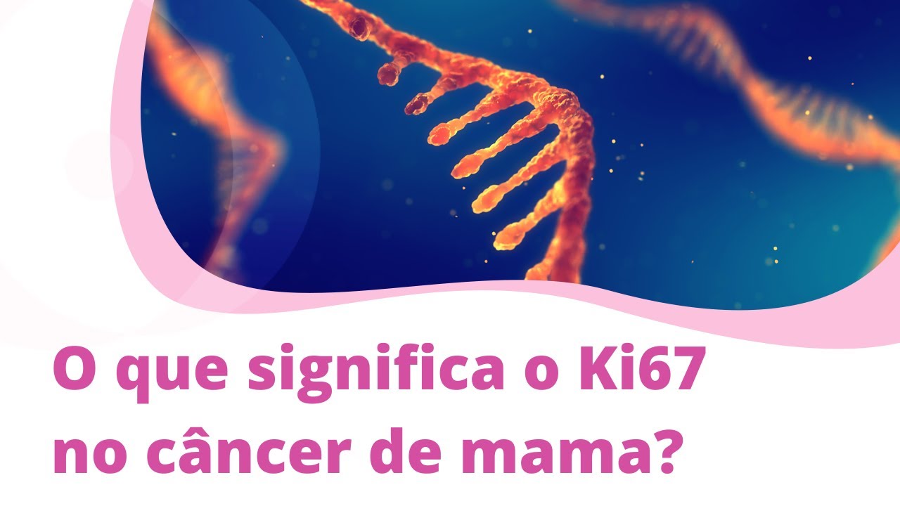 O que significa o Ki67 no câncer de mama
