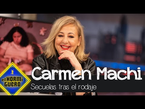 Carmen Machi y sus secuelas tras el rodaje - El Hormiguero