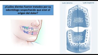 Sabes sí un dolor dental es por neuralgia del trigémino en #NeurologíaSegura tenemos la respuesta