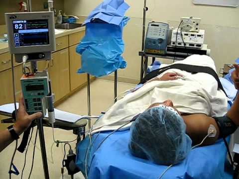 Propofol Induction Using BIS Monitor without Instrumenting Airway