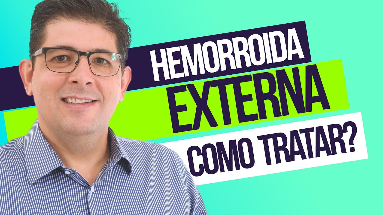 Hemorroida externa, como tratar | Dr Juliano Teles