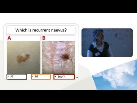 PHARMAC Seminar Series: Dermoscopy, 2c of 5. Melanocytic and nonmelanocytic lesions - part 3