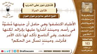 ما حكم إنزال الجنين المشوه بشهادة الأطباء؟ الشيخ صالح الفوزان image