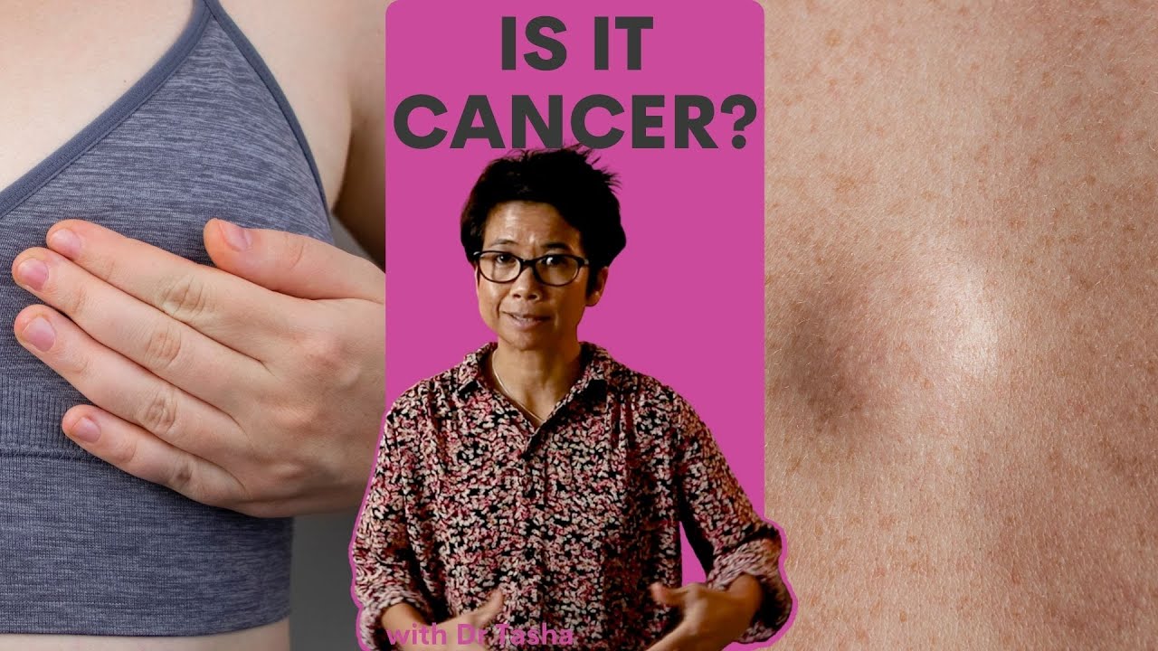 Are All Breast Lumps Cancer? With Dr Tasha