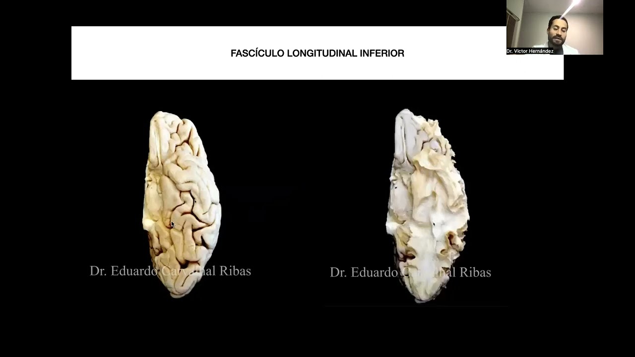 Victor Hernandez Alvarez-5